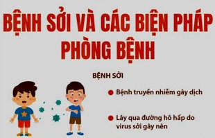 Ngành Y tế khuyến cáo phòng chống bệnh Sởi